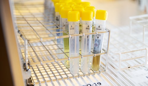 Ett ställ fyllt med gula och vita rör på ett bord.